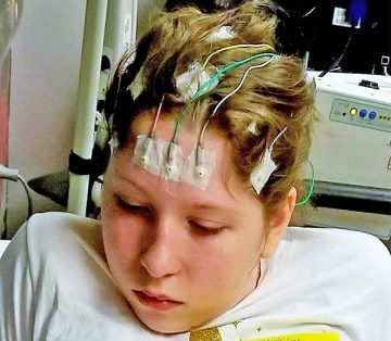 Leads applied to child's head during an EEG test