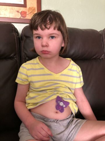 Sydney with purple butterfly G-tube cover